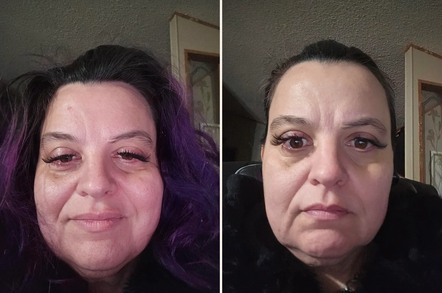 Before and after: 48, running the GLOW stack for skin
