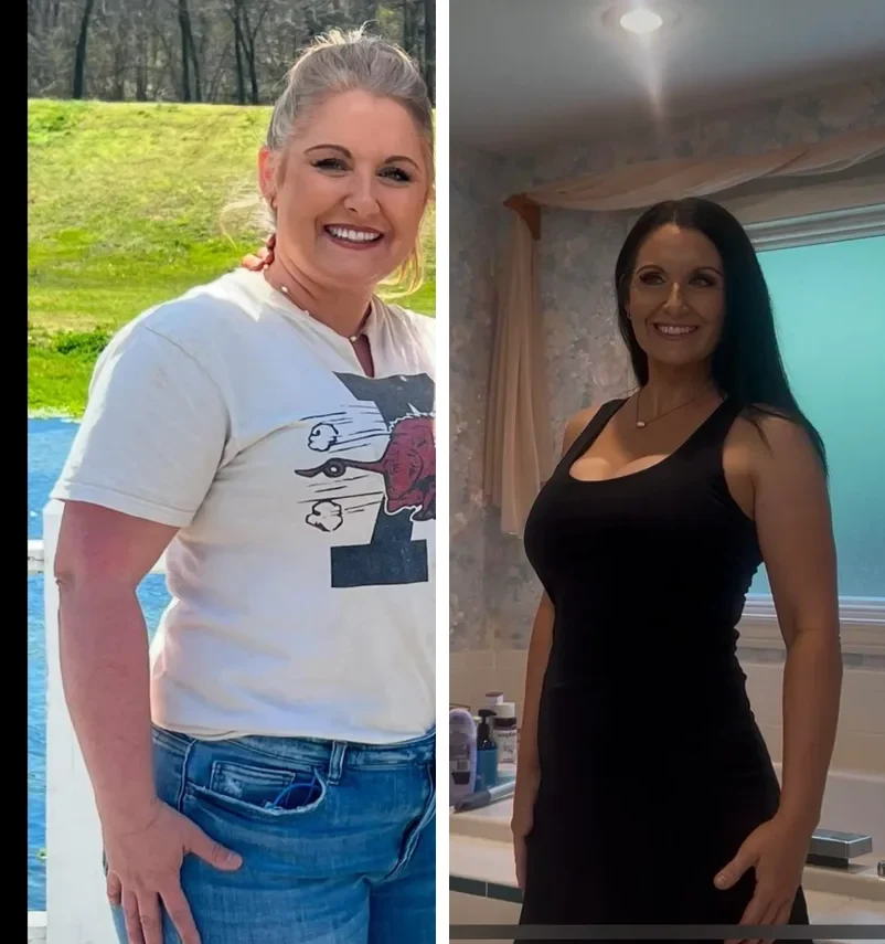 Before and after: 70 lbs down at 47, “Zepbound changed my life”